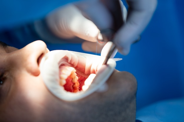 Pacient in tandheelkundige kliniek tijdens operatie