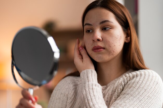 Persoon die te maken heeft met rosacea