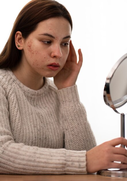 Persoon die te maken heeft met rosacea