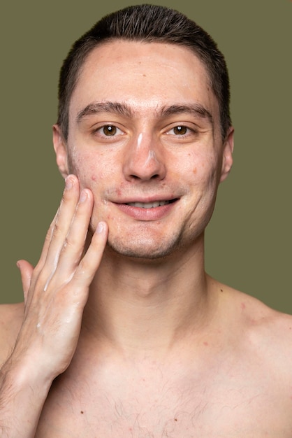 Portret van een jonge man die vertrouwen heeft met acne