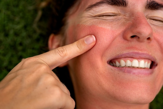 Portret van volwassen vrouw met zonnebrandhuid