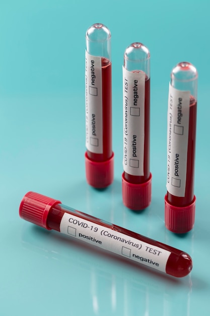 Regeling bloedmonsters coronavirus in laboratorium