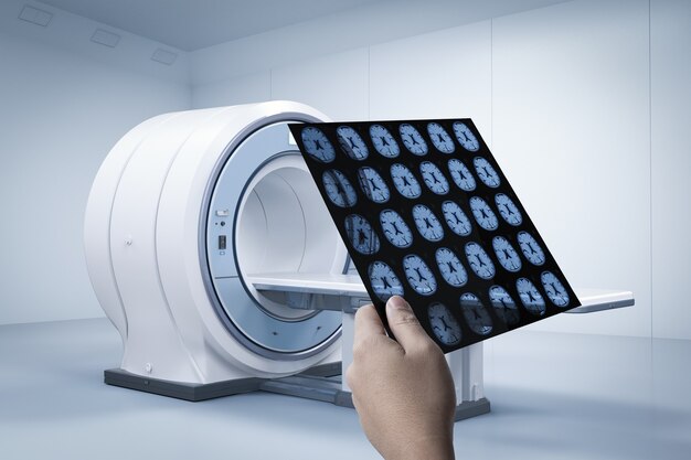 Röntgenfilm met mri-scanmachine of scanapparaat voor magnetische resonantiebeeldvorming