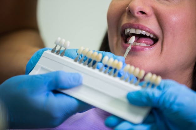 Tandarts die vrouwelijke patiënt met tandenschaduwen onderzoeken