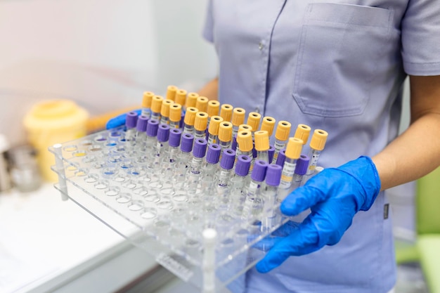 Technicus die een bloedbuistest houdt in het onderzoekslaboratorium Coronavirus-testen Arts die een bloedmonsterbuis uit een rek in het laboratorium neemt