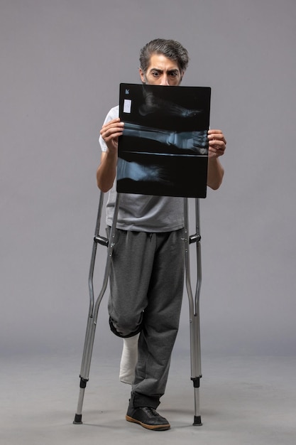 Vooraanzicht jonge man met gebroken voet die krukken gebruikt en zijn röntgenfoto op de grijze muur houdt, gebroken ongeval pijn voetdraai uitschakelen