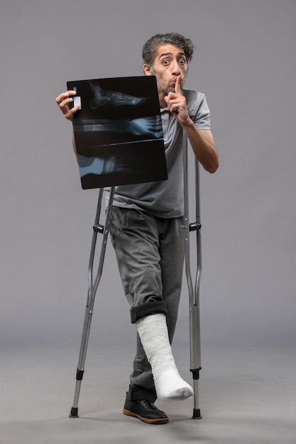 Vooraanzicht jonge man met gebroken voet met krukken en met zijn röntgenfoto op de grijze muur pijn uitschakelen ongeval voet twist gebroken
