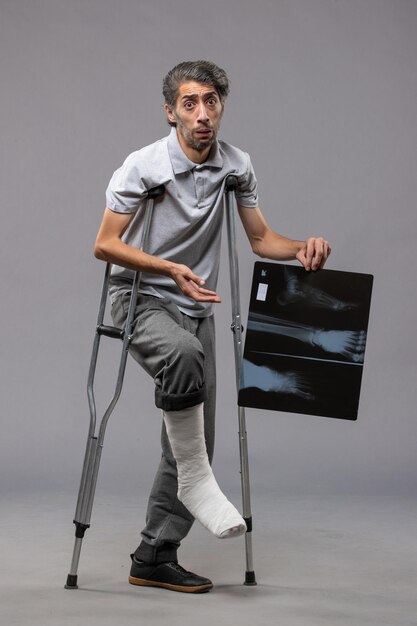 Vooraanzicht jonge man met gebroken voet met krukken en zijn röntgenfoto op de grijze muur houden pijn uitschakelen draai gebroken ongeval voet