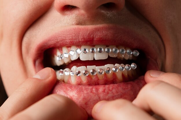Vooraanzicht man poseren met tandheelkundige edelstenen