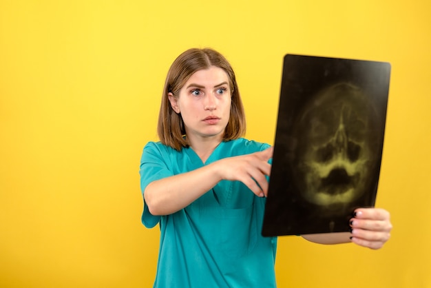 Gratis foto vooraanzicht vrouwelijke arts die röntgenfoto op gele ruimte bekijkt
