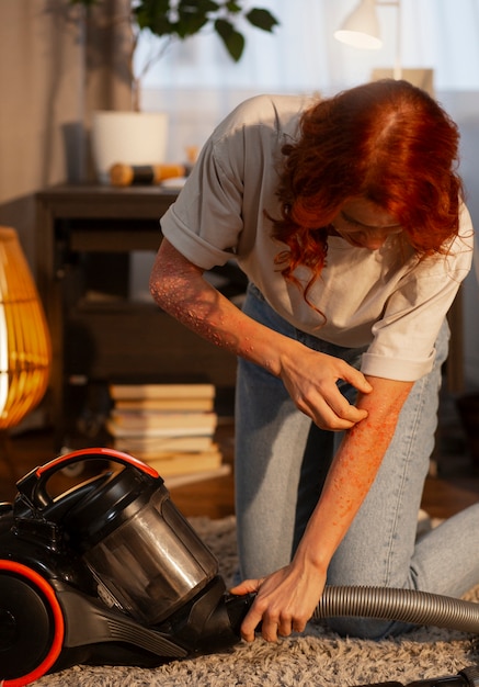 Gratis foto voorbeeld van een vrouw met een huidziekte