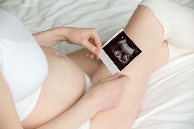 Vrouw die een echo foto