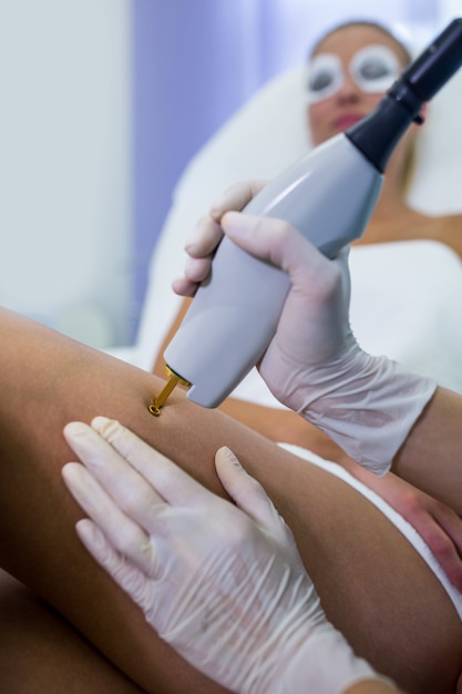 Vrouw die laser epilatiebehandeling op haar been ontvangt