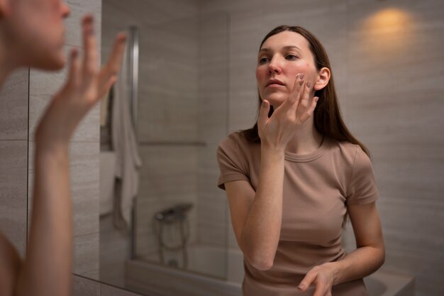 Vrouw die vochtinbrengende crème gebruikt om te helpen bij de huidaandoening van rosacea