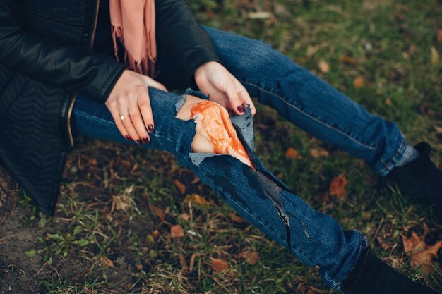 Vrouw met een beenblessure. Het gewonde meisje dat bij de boom zit. De wond bloedt.