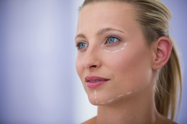 Vrouw met merken getekend voor cosmetische behandeling