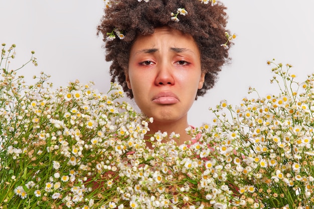 Vrouw omringd door kamille bloemen heeft rood gezwollen oog loopneus lijdt aan seizoensgebonden pollenallergie heeft advies van immunoloog nodig