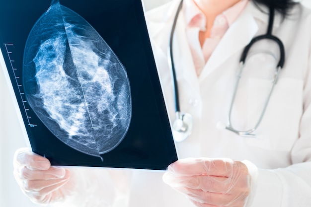 Vrouwelijke arts die mammografieresultaten op x-ray bekijkt