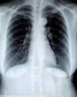 Gratis foto vrouwelijke borst röntgenstraal
