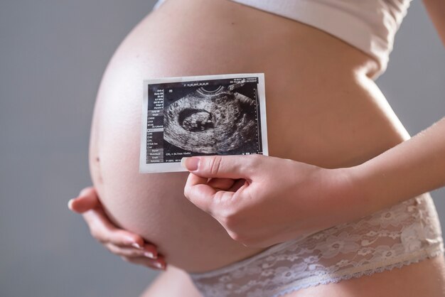 zwangere vrouw die een röntgenfoto voor haar buikhoogte houdt