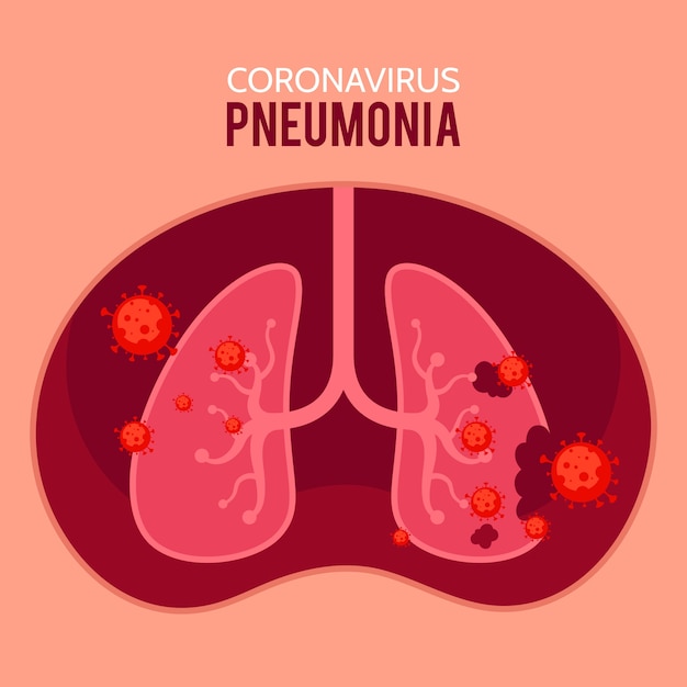 Gratis vector coronavirus longontsteking concept