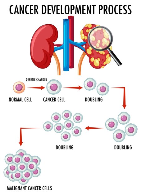 Diagram met het ontwikkelingsproces van kanker