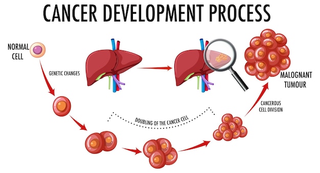 Diagram met het ontwikkelingsproces van kanker