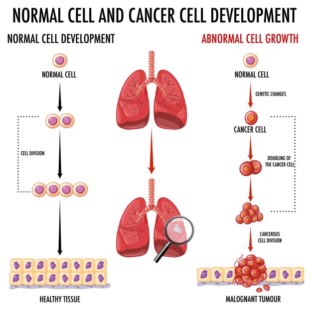 Diagram met het ontwikkelingsproces van kanker