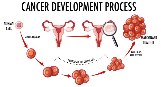 Diagram met het ontwikkelingsproces van kanker