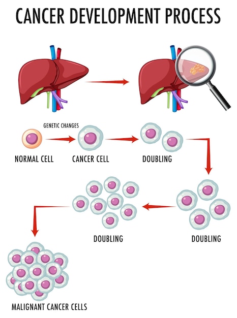 Gratis vector diagram met het ontwikkelingsproces van kanker