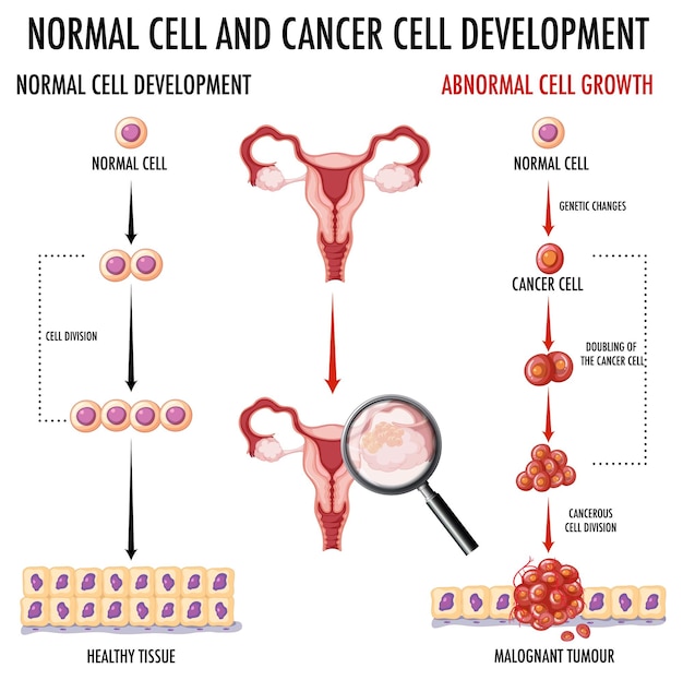 Gratis vector diagram met normale en kankercellen bij mensen