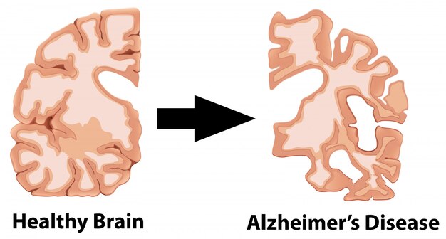 Een menselijke anatomie van hersenen