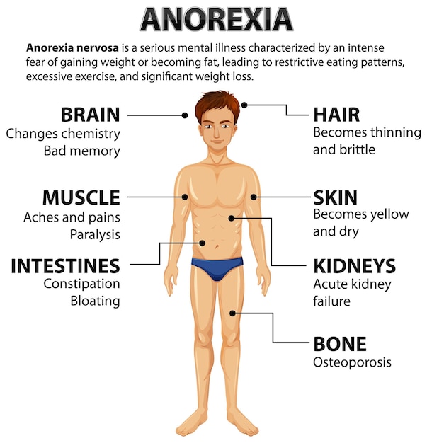 Gratis vector effecten van anorexia op de mannelijke anatomie