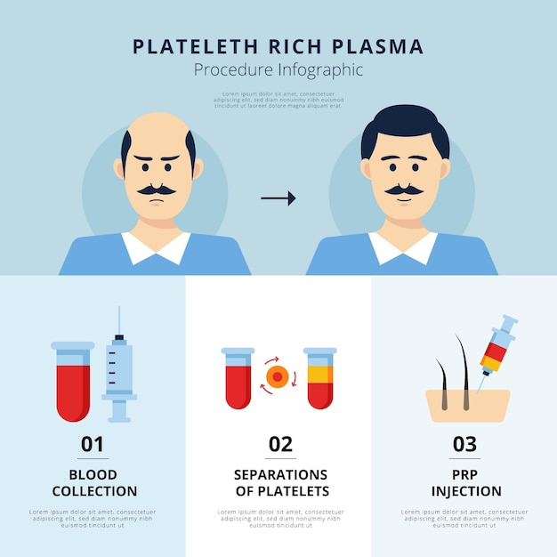 Flat-hand getekende prp-procedure infographic