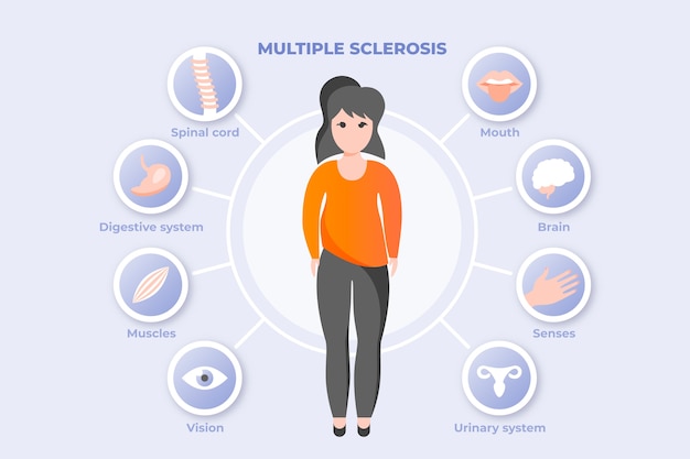 Gradiënt multiple sclerose infographic