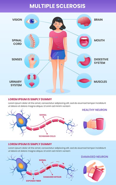 Gradiënt multiple sclerose infographic