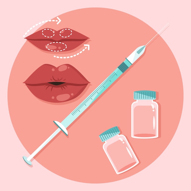 Gratis vector hand getekende platte ontwerp lip filler illustratie