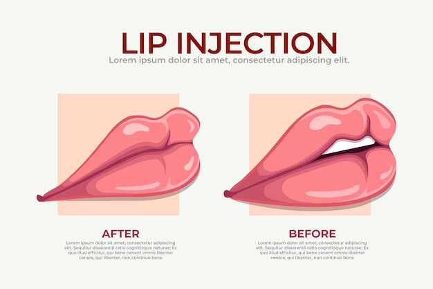 Gratis vector handgetekende lipvuller infographic