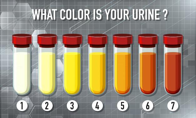 Gratis vector illustratie van de kleurenkaart van de urine