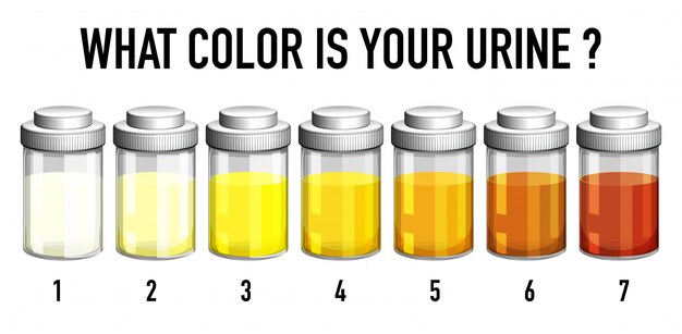 Illustratie van de kleurenkaart van de urine