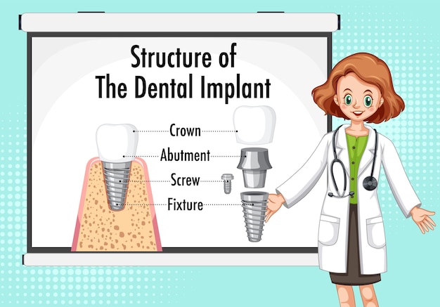 Infographic van de mens in de structuur van het tandheelkundig implantaat