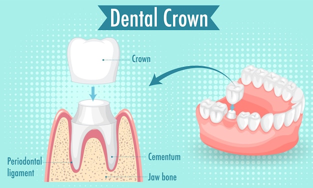 Infographic van mens in tandkroon