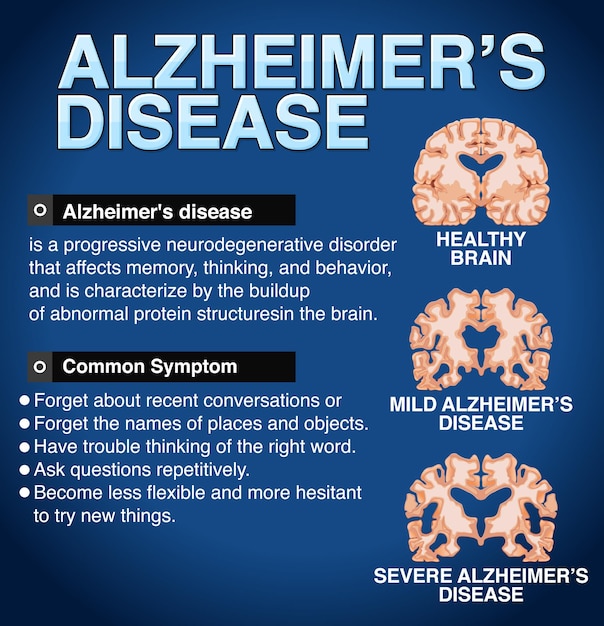 Gratis vector informatieve poster over de ziekte van alzheimer