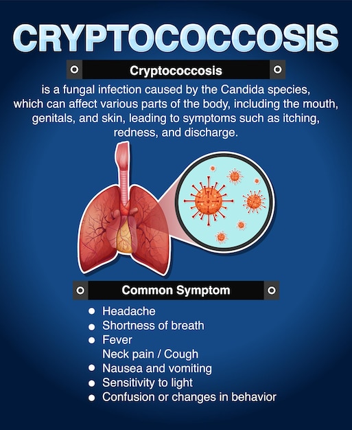 Informatieve poster van cryptokokkose