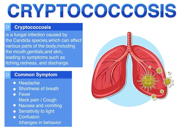 Informatieve poster van cryptokokkose