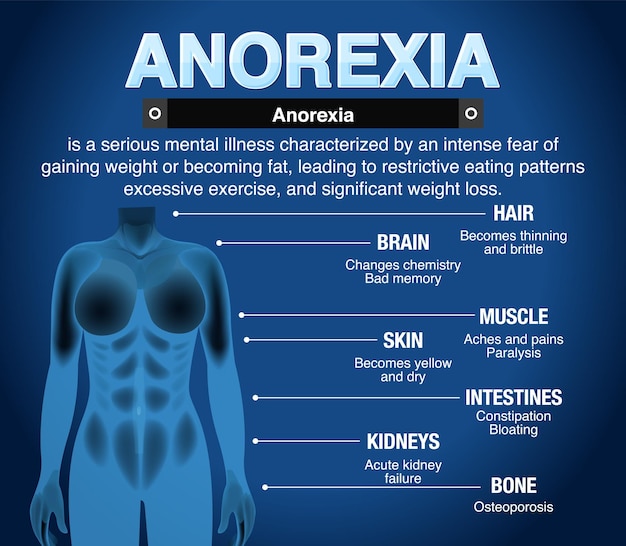 Gratis vector informatieve poster van de eetstoornis anorexia