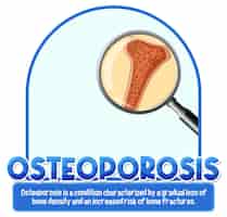 Gratis vector informatieve poster van osteoporose menselijke bot