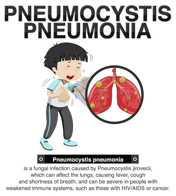 Gratis vector informatieve poster van pneumocystis longontsteking