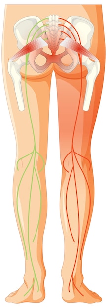 Gratis vector lage rug die lijdt aan spondylitis ankylopoetica