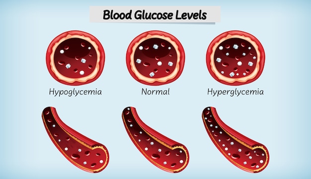 Gratis vector medische bloedglucosespiegel